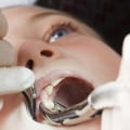 Can Kids Receive TENS Treatments in Dentistry?